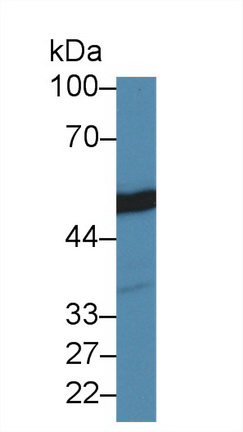 Polyclonal Antibody to Tubulin Beta (TUBb)