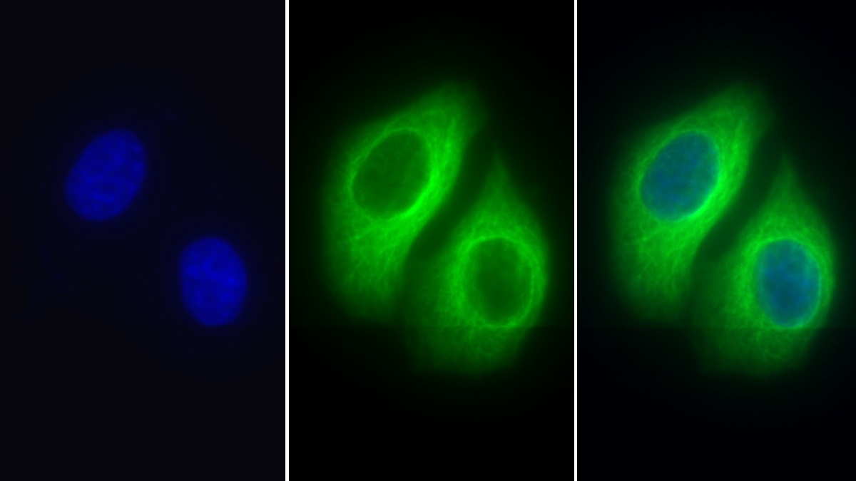 Polyclonal Antibody to Tubulin Beta (TUBb)