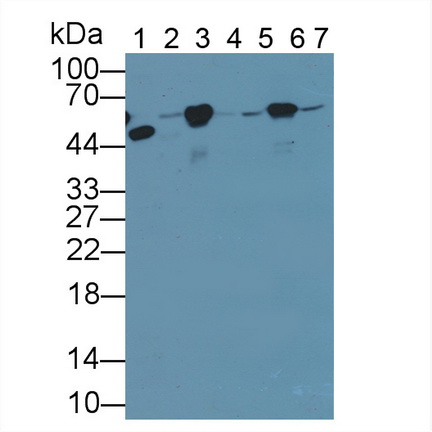 Polyclonal Antibody to Tubulin Beta (TUBb)