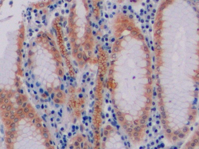 Polyclonal Antibody to Cluster Of Differentiation 19 (CD19)