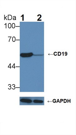 Polyclonal Antibody to Cluster Of Differentiation 19 (CD19)
