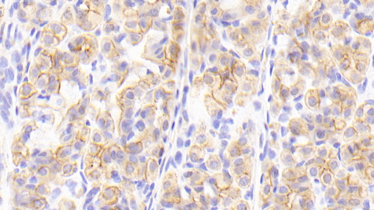 Polyclonal Antibody to Cytokeratin 13 (CK13)