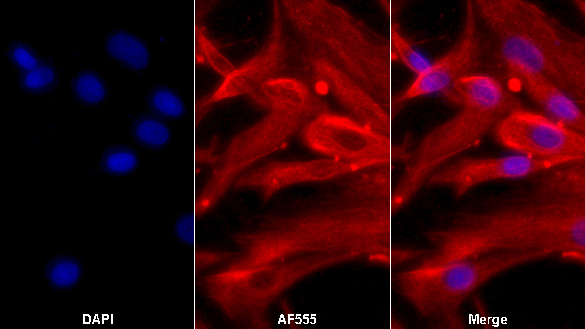 Polyclonal Antibody to Coagulation Factor VIII (F8)