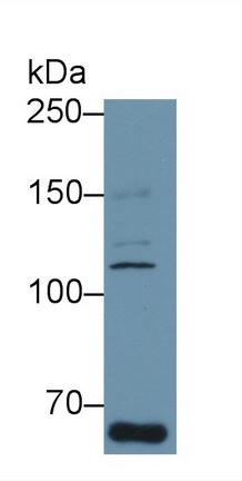 Polyclonal Antibody to Coagulation Factor VIII (F8)