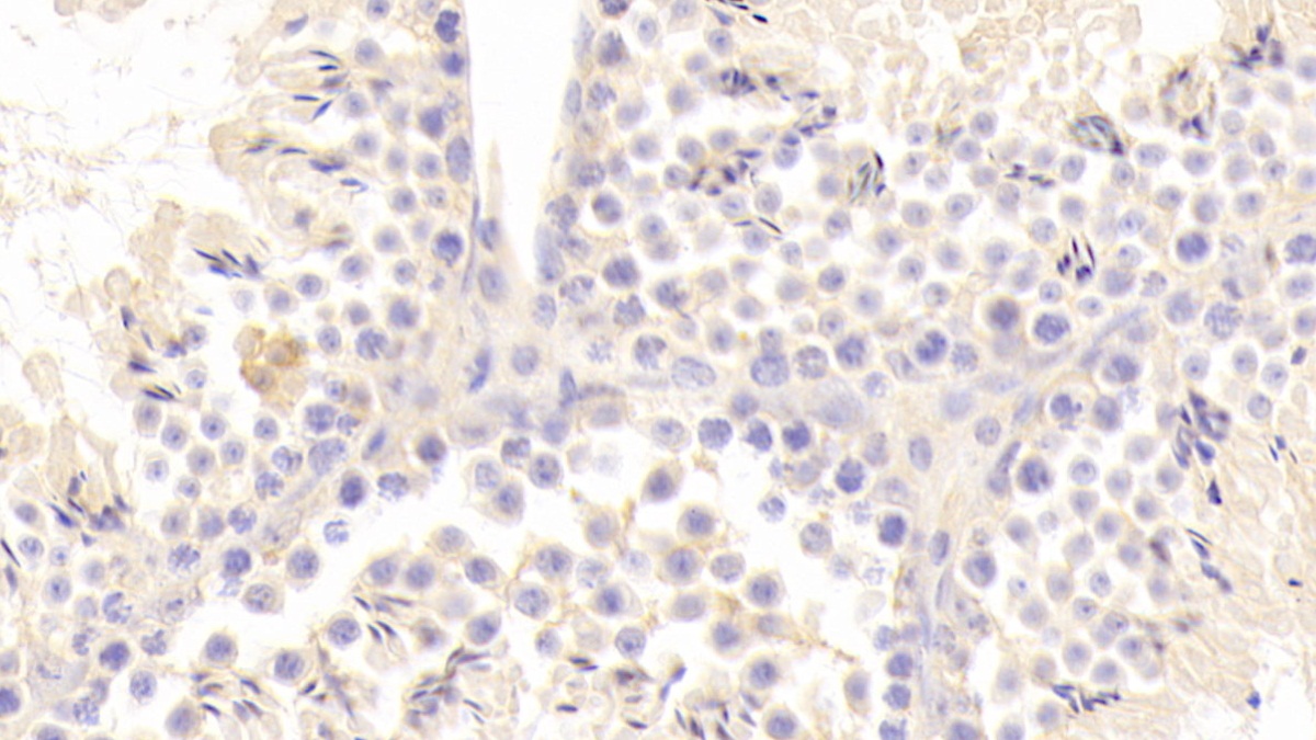 Polyclonal Antibody to Angiotensin I Converting Enzyme 2 (ACE2)