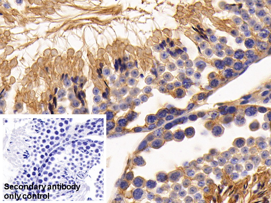 Polyclonal Antibody to Angiotensin I Converting Enzyme 2 (ACE2)