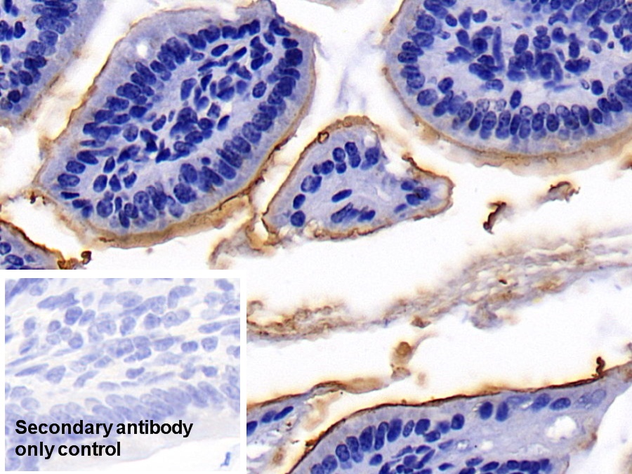 Polyclonal Antibody to Angiotensin I Converting Enzyme 2 (ACE2)