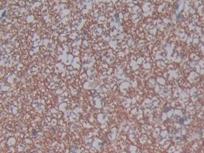 Polyclonal Antibody to Angiotensin I Converting Enzyme 2 (ACE2)