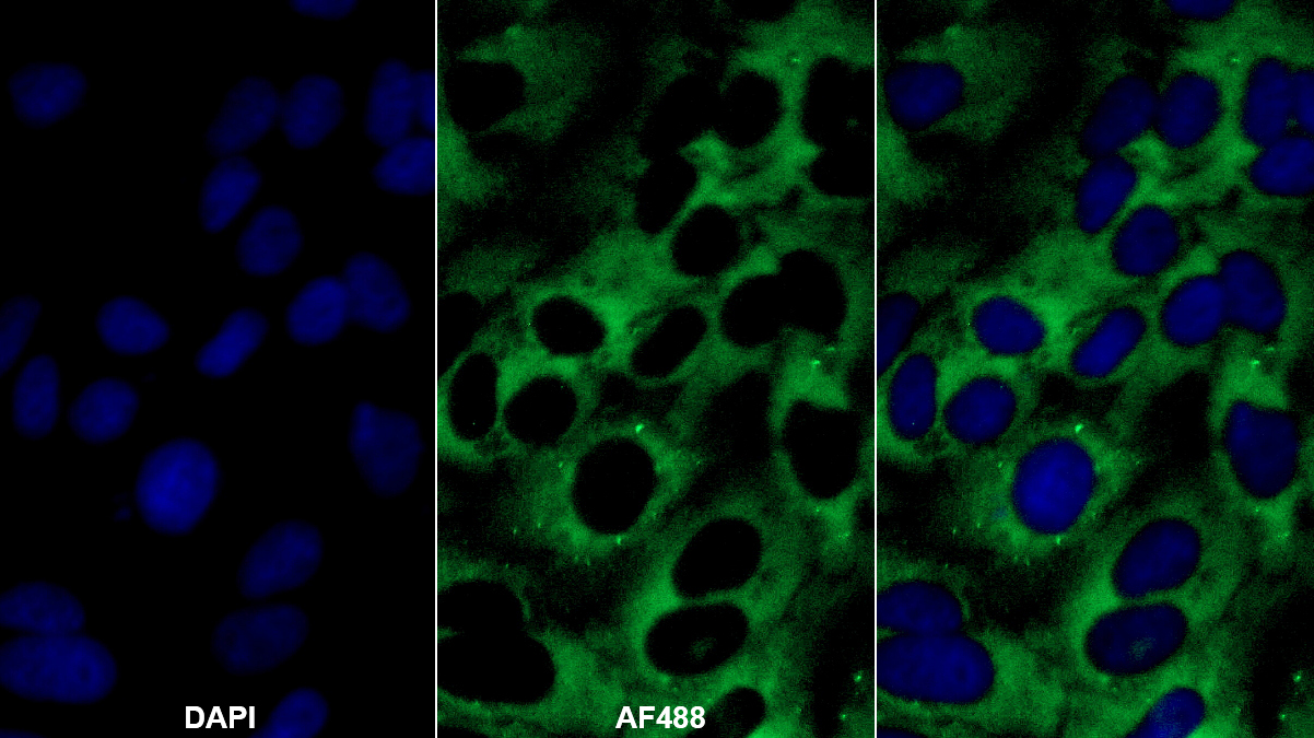 Polyclonal Antibody to Cyclin Dependent Kinase 2 (CDK2)