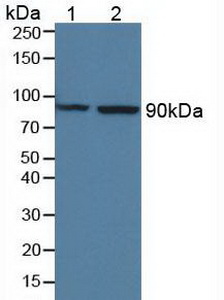 Polyclonal Antibody to Mannose Associated Serine Protease 1 (MASP1)