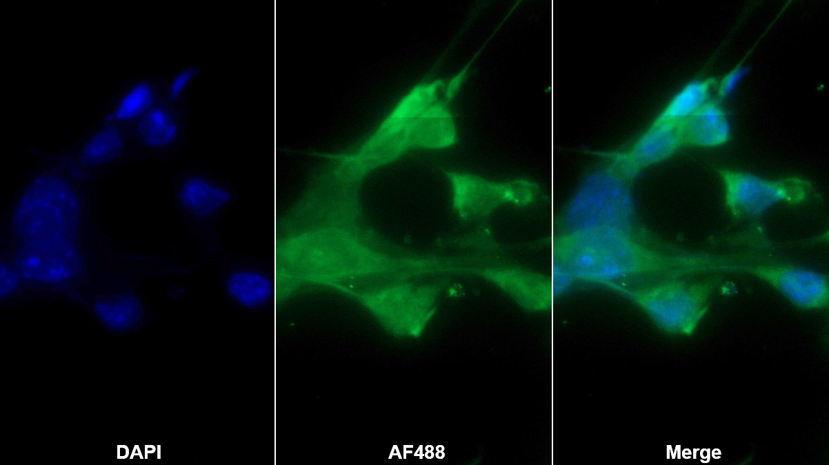 Polyclonal Antibody to Mannose Associated Serine Protease 1 (MASP1)