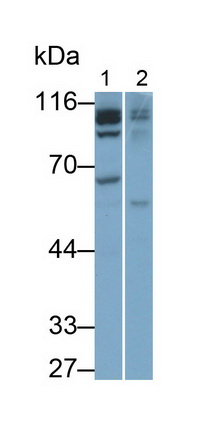 Polyclonal Antibody to Insulin Degrading Enzyme (IDE)