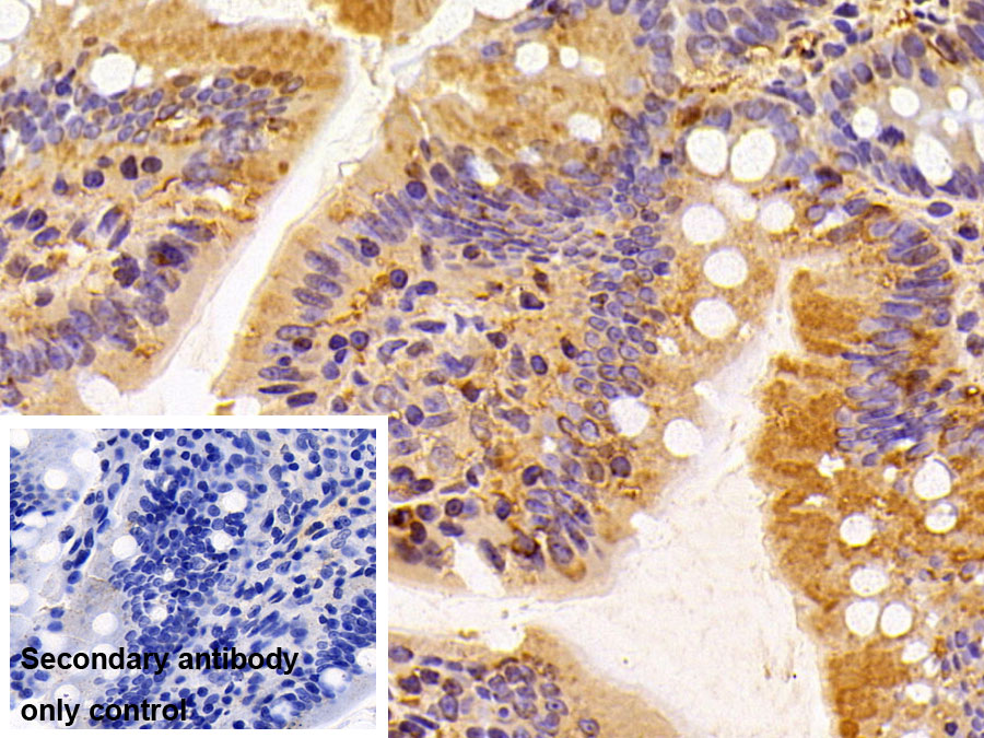 Polyclonal Antibody to Insulin Degrading Enzyme (IDE)