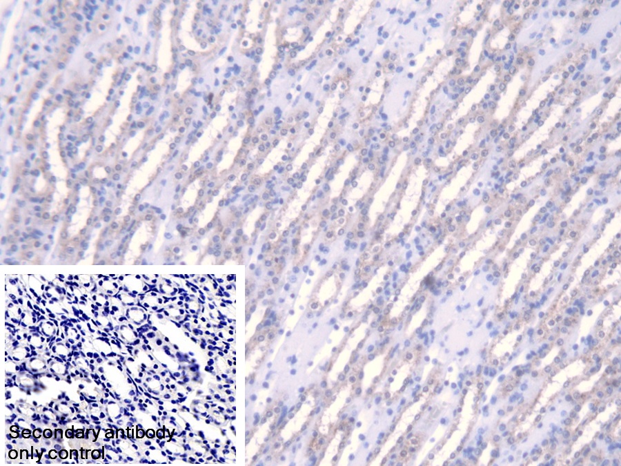 Polyclonal Antibody to Fumarase (FUM)