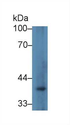 Polyclonal Antibody to Glyceraldehyde-3-Phosphate Dehydrogenase (GAPDH)