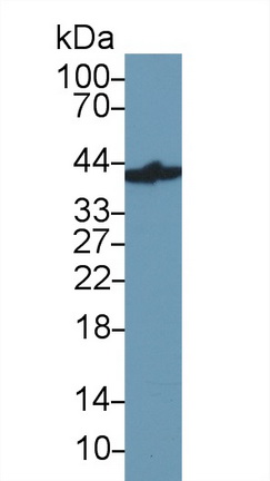 Polyclonal Antibody to Glyceraldehyde-3-Phosphate Dehydrogenase (GAPDH)