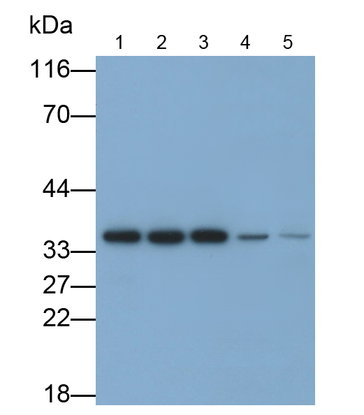 Polyclonal Antibody to Glyceraldehyde-3-Phosphate Dehydrogenase (GAPDH)