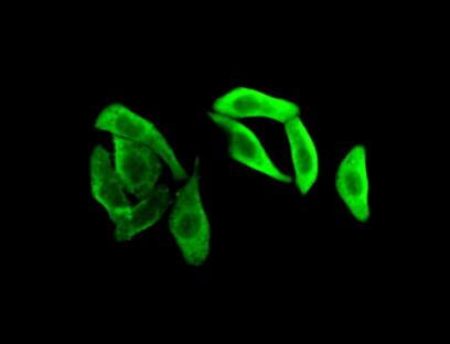 Polyclonal Antibody to Glyceraldehyde-3-Phosphate Dehydrogenase (GAPDH)