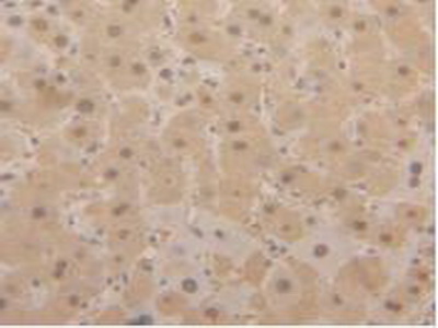 Polyclonal Antibody to Glyceraldehyde-3-Phosphate Dehydrogenase (GAPDH)