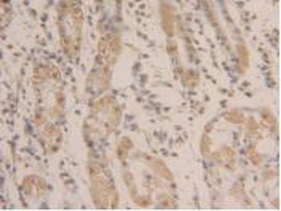 Polyclonal Antibody to Glyceraldehyde-3-Phosphate Dehydrogenase (GAPDH)