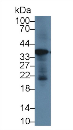 Polyclonal Antibody to Glyceraldehyde-3-Phosphate Dehydrogenase (GAPDH)