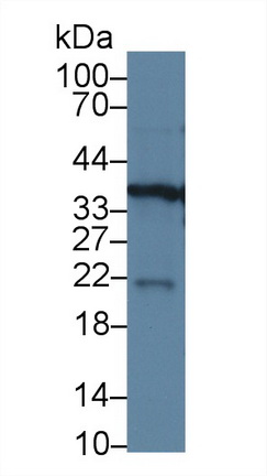 Polyclonal Antibody to Glyceraldehyde-3-Phosphate Dehydrogenase (GAPDH)