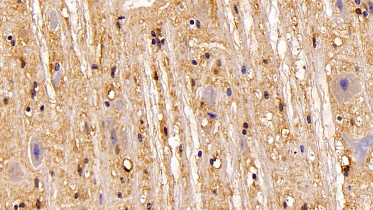 Polyclonal Antibody to Glyceraldehyde-3-Phosphate Dehydrogenase (GAPDH)