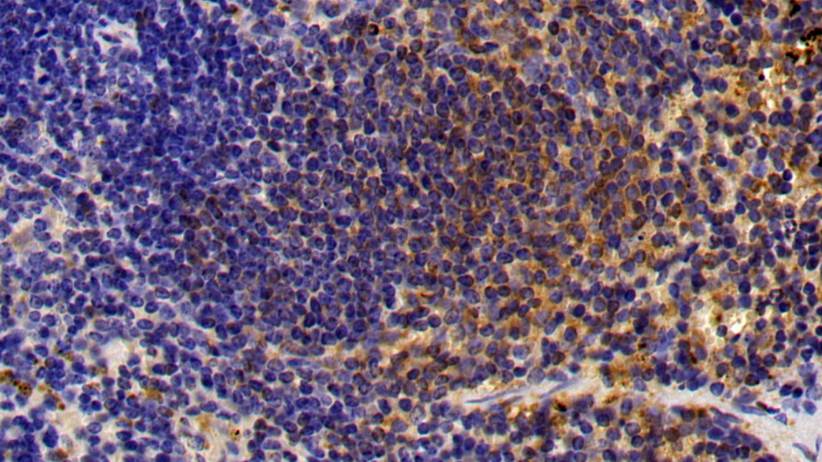 Polyclonal Antibody to Cathepsin S (CTSS)