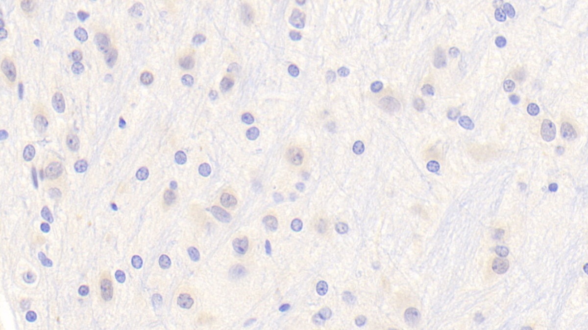 Polyclonal Antibody to Leucine Rich Alpha-2-Glycoprotein 1 (LRG1)