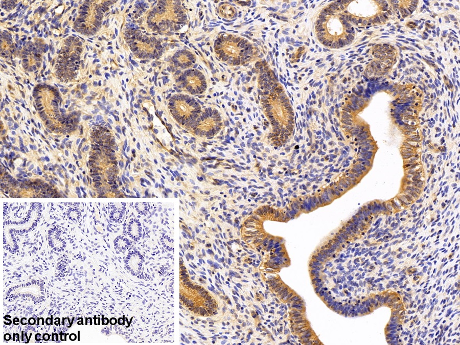 Polyclonal Antibody to Annexin A2 (ANXA2)