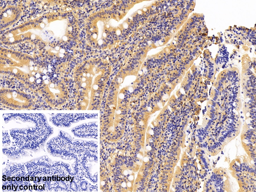 Polyclonal Antibody to Annexin A2 (ANXA2)