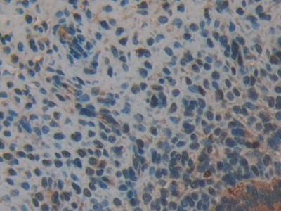 Polyclonal Antibody to Annexin A2 (ANXA2)