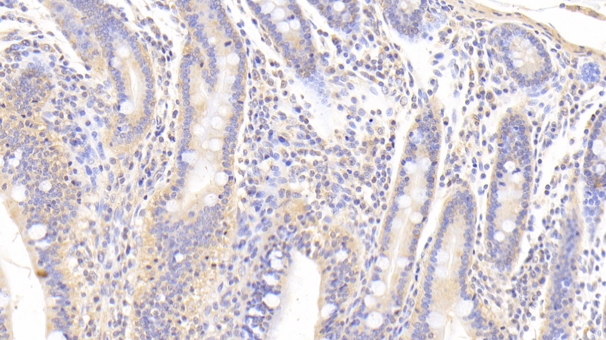 Polyclonal Antibody to Transforming Growth Factor Beta 3 (TGFb3)