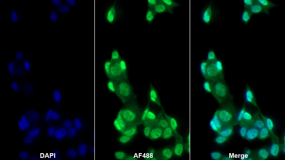 Polyclonal Antibody to Tar DNA Binding Protein 43kDa (TDP43)