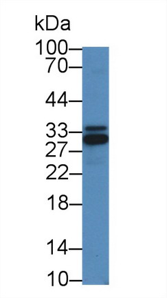 Polyclonal Antibody to Inhibitor Of Nuclear Factor Kappa B Kinase Interacting Protein (IKBIP)