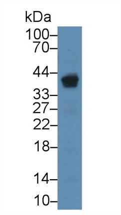 Polyclonal Antibody to Inhibitor Of Nuclear Factor Kappa B Kinase Interacting Protein (IKBIP)