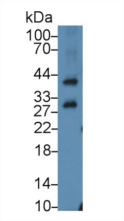 Polyclonal Antibody to Inhibitor Of Nuclear Factor Kappa B Kinase Interacting Protein (IKBIP)