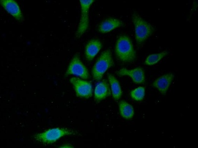 Polyclonal Antibody to Monoamine Oxidase A (MAOA)