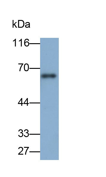 Polyclonal Antibody to Monoamine Oxidase A (MAOA)