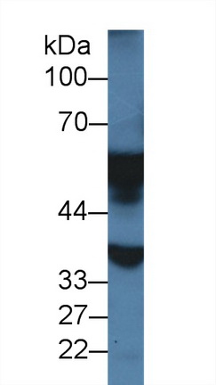 Polyclonal Antibody to Monoamine Oxidase A (MAOA)