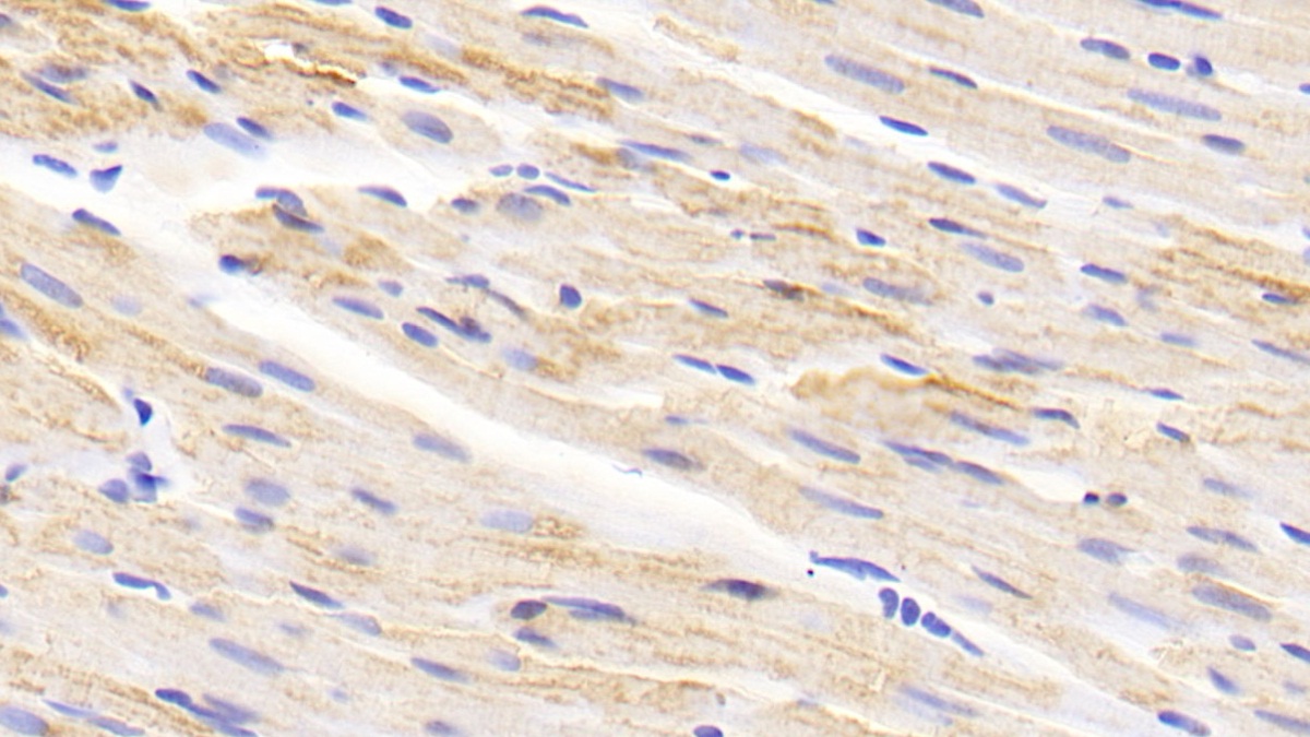 Polyclonal Antibody to Monoamine Oxidase A (MAOA)