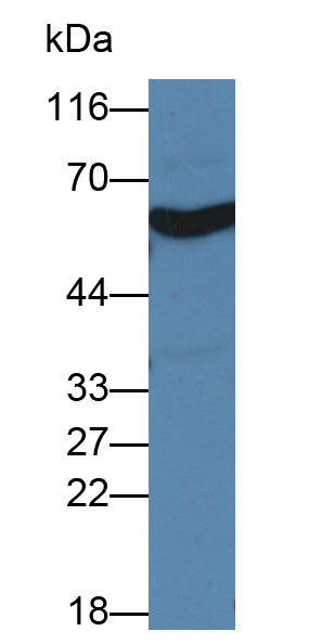 Polyclonal Antibody to Monoamine Oxidase A (MAOA)