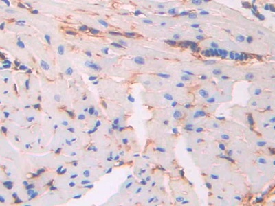 Polyclonal Antibody to Cluster Of Differentiation 34 (CD34)