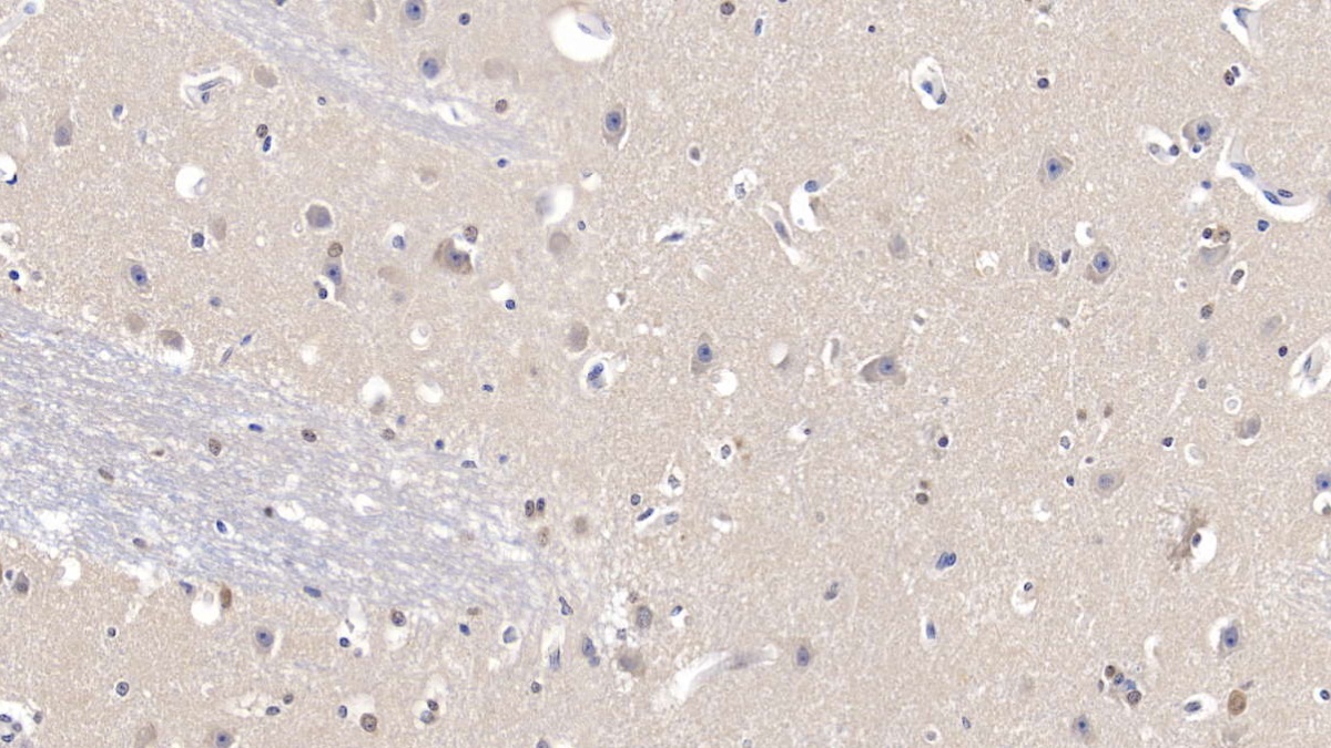 Polyclonal Antibody to Superoxide Dismutase 1 (SOD1)