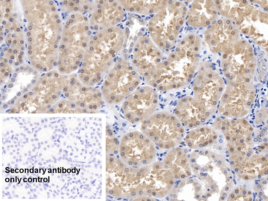 Polyclonal Antibody to Superoxide Dismutase 1 (SOD1)