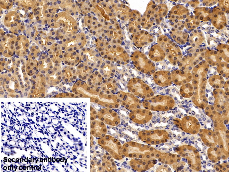 Polyclonal Antibody to Superoxide Dismutase 1 (SOD1)