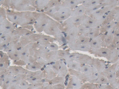 Polyclonal Antibody to Superoxide Dismutase 1 (SOD1)