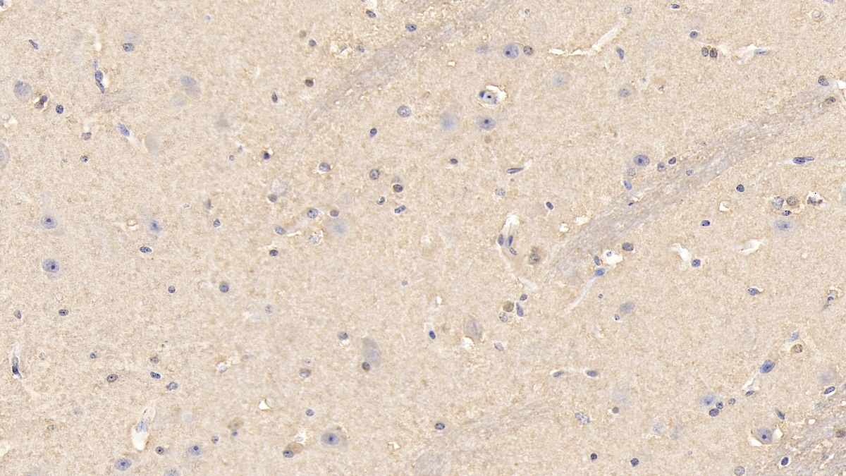 Polyclonal Antibody to Superoxide Dismutase 1 (SOD1)