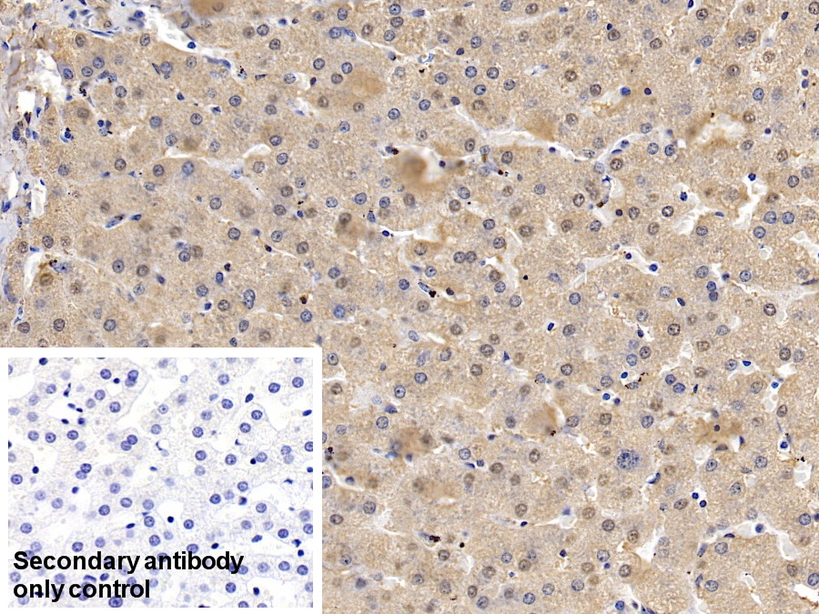 Polyclonal Antibody to Superoxide Dismutase 1 (SOD1)