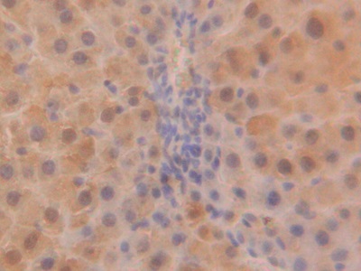 Polyclonal Antibody to Superoxide Dismutase 1 (SOD1)